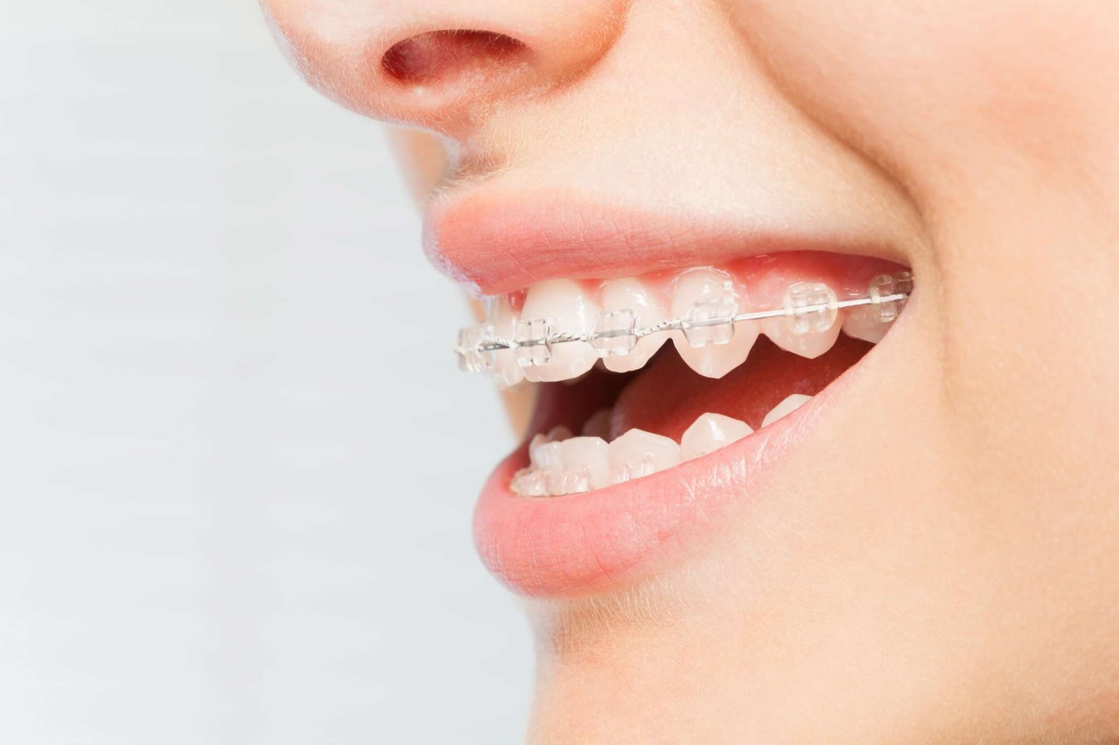north miami beach orthodontist