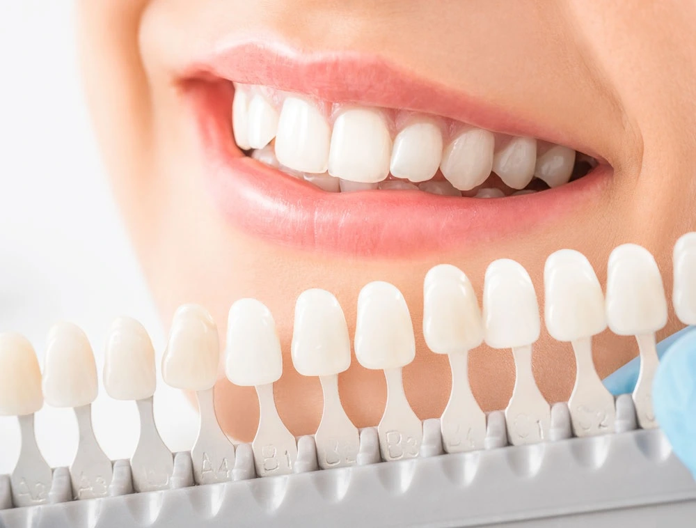 houston cosmetic dentist