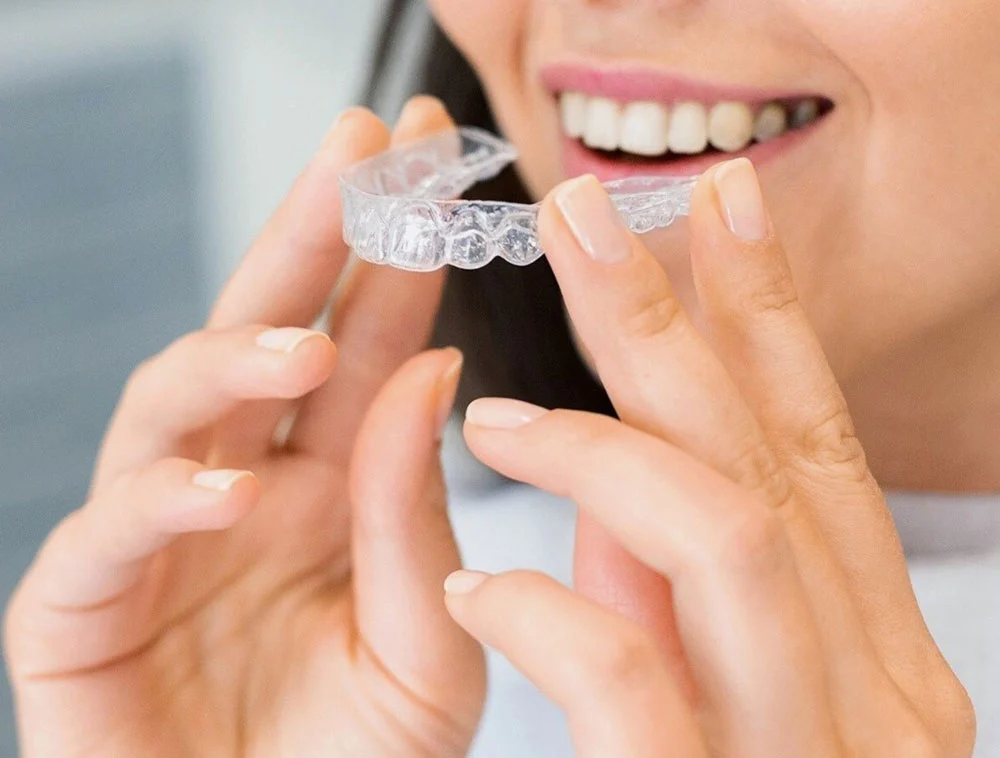 best veneers houston
